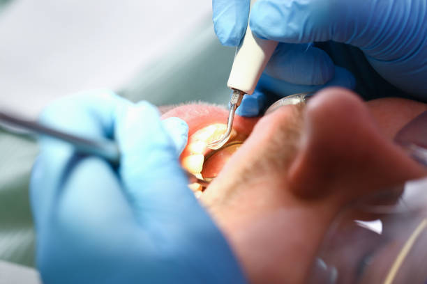 Best Orthodontic Emergency Dentist in Hamburg, IA